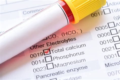 total calcium blood test results